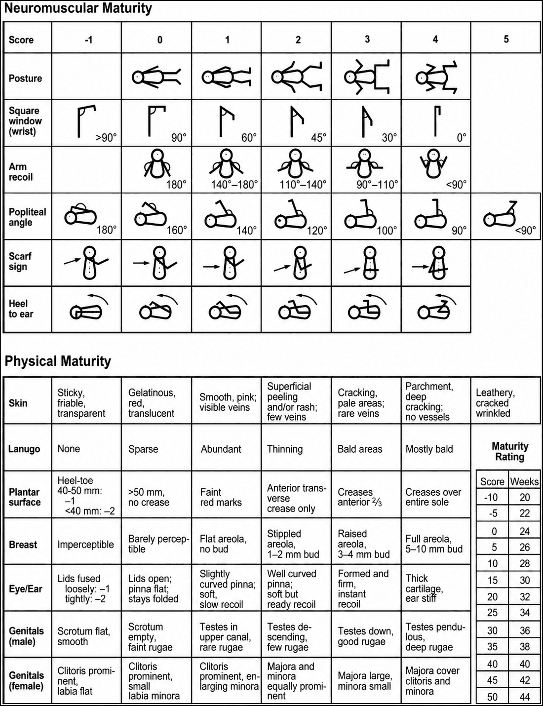 New Ballard Score chart: neuromuscular maturity (posture, square window, arm recoil, popliteal angle, scarf sign, heel to ear), physical maturity (skin, lanugo, plantar surface, breast, eye/ear, genitals), and the maturity rating table converting total score to gestational age in weeks
